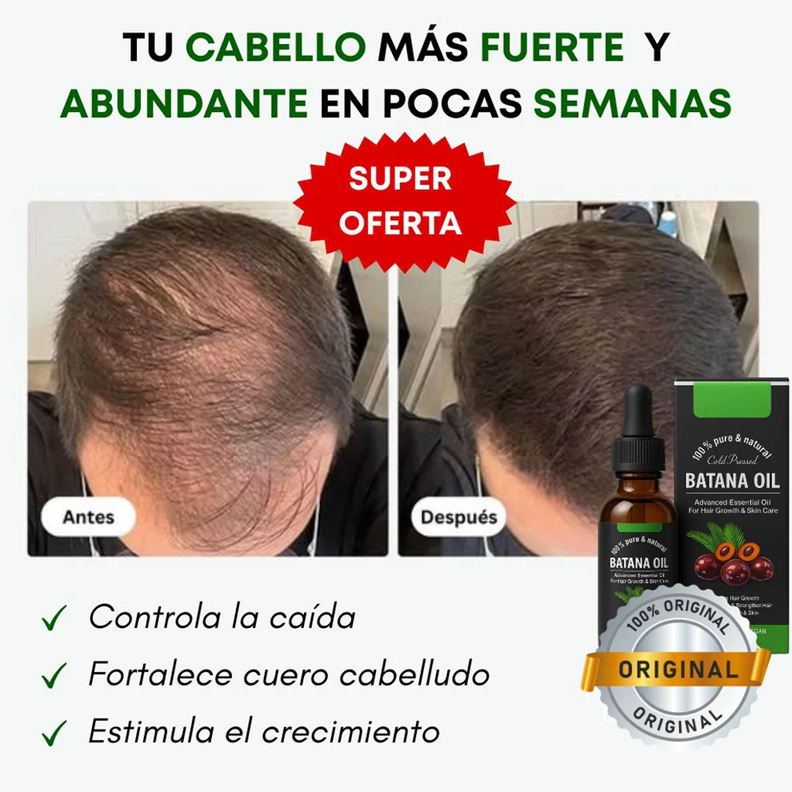 ✨🍀Aceite Batana ORIGINAL: El Secreto Ancestral para Prevenir la Caída del Cabello y Estimular el Crecimiento ✔