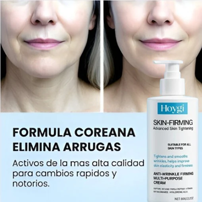 HOYGI™ Skin-Firming | Crema Reafirmante 🍀
